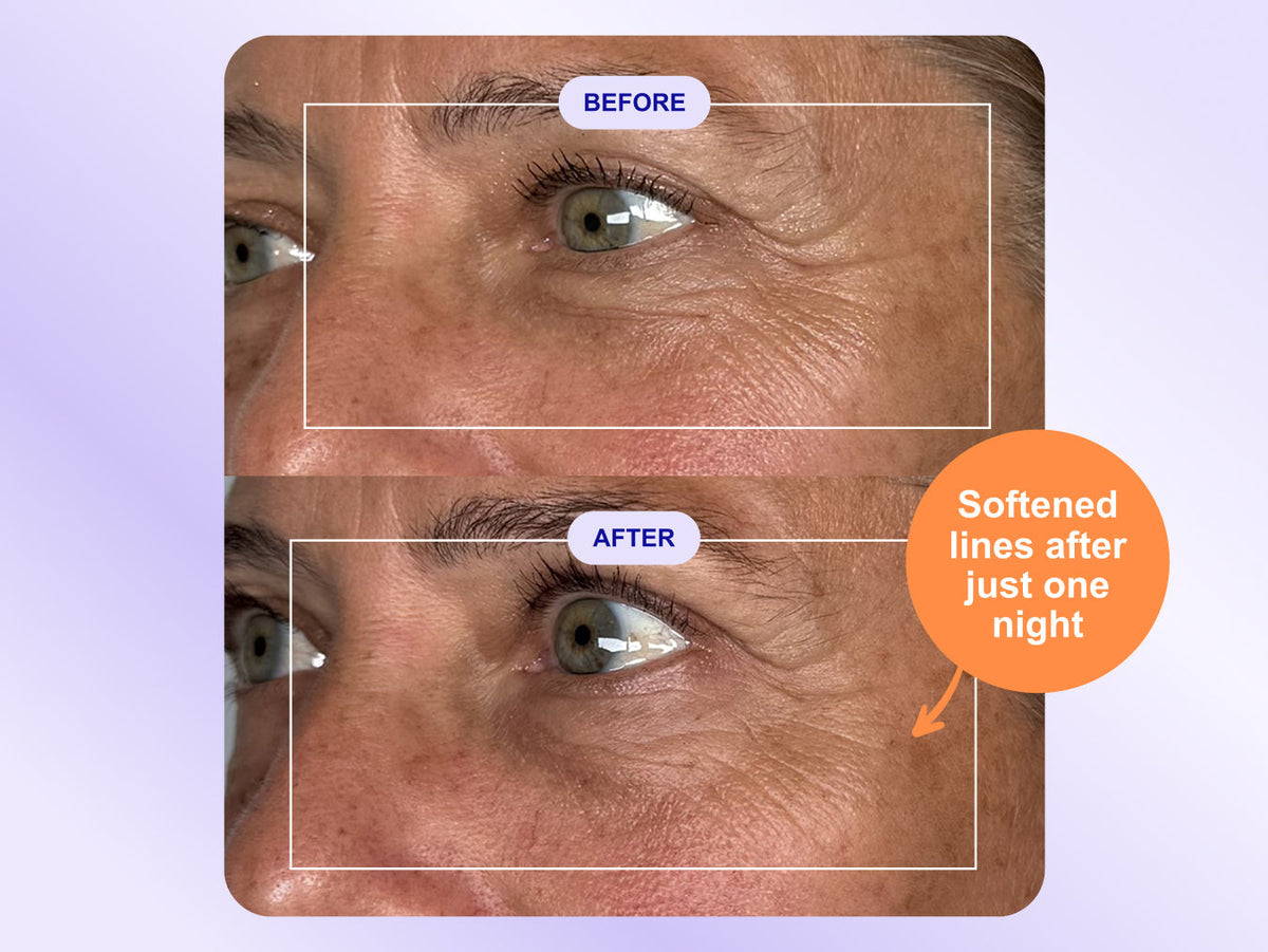 Wrinkles Schminkles blog banner for clinically tested overnight eye wrinkle patches