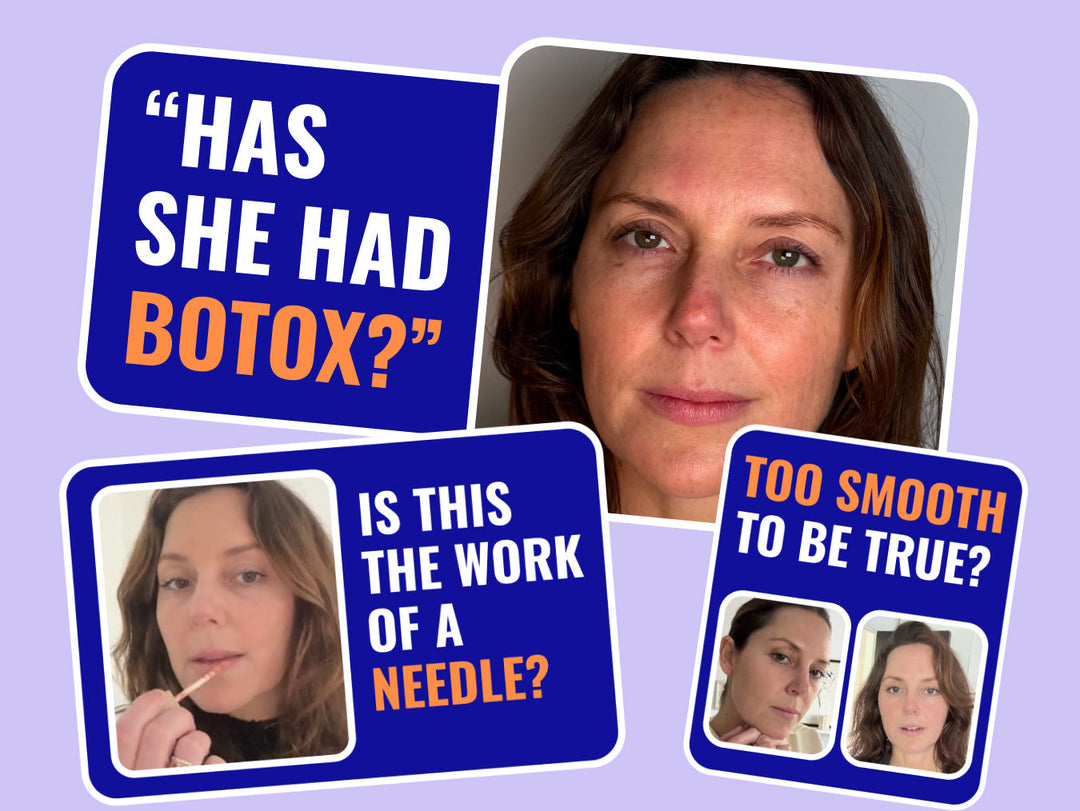 The Botox Alternative That’ll Have People Asking Who Your Injector Is!
