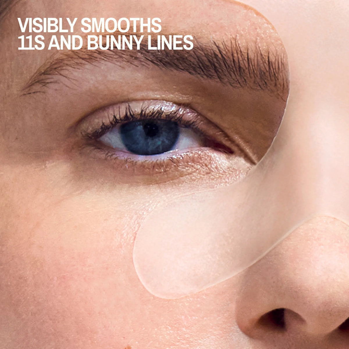Brow Frown & Bunny Lines Wrinkle Patches