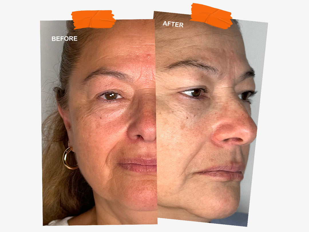 Wrinkles Schminkles blog banner showing before and after results of overnight wrinkle patches
