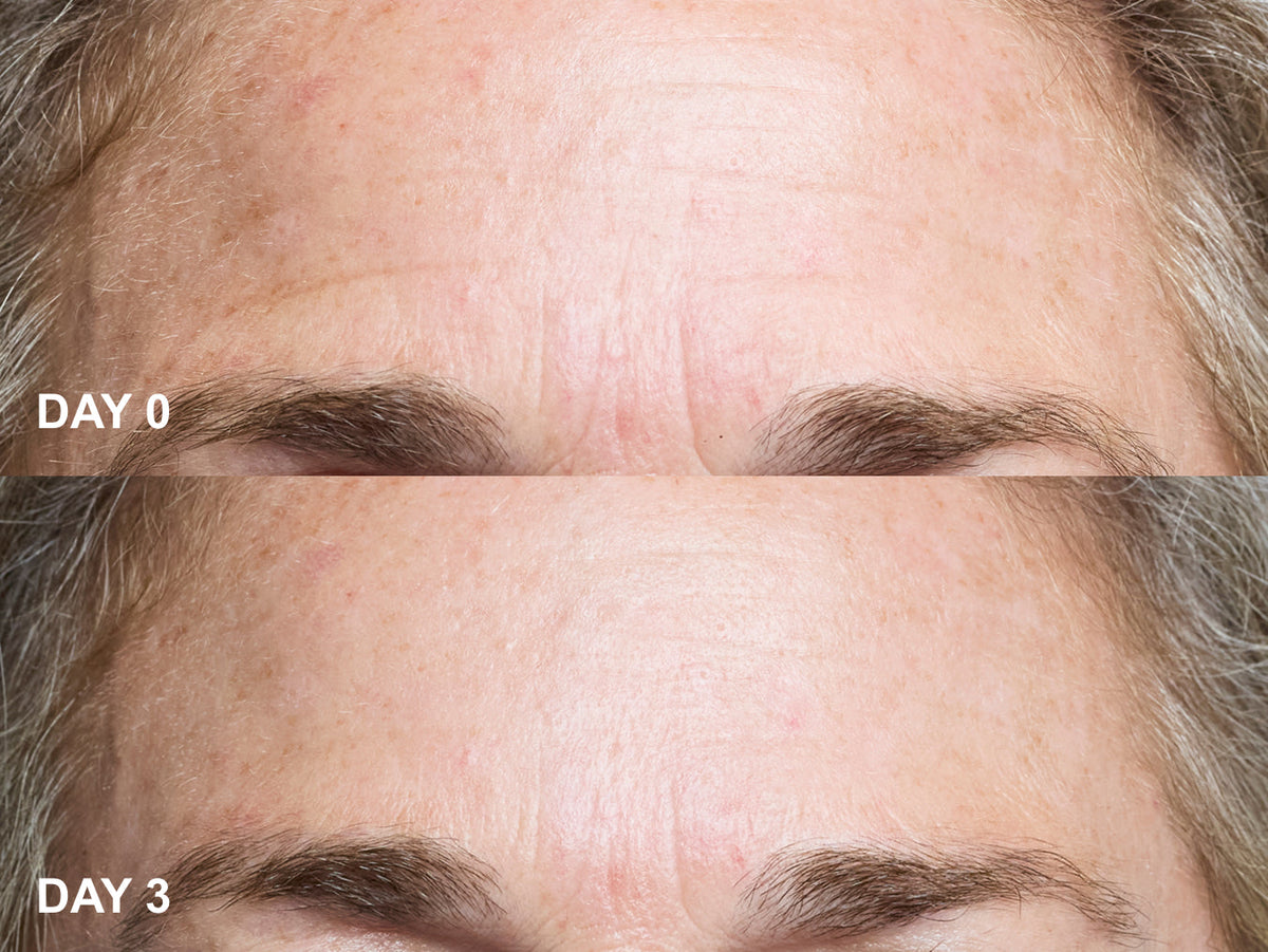 Wrinkles Schminkles blog banner for forehead wrinkle patches, smoothing frown lines and eleven lines overnight
