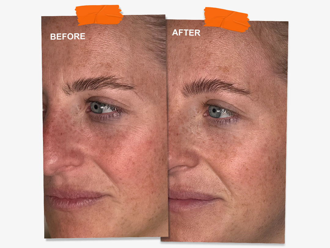 Wrinkles Schminkles blog banner on overnight wrinkle patch results in your 30s