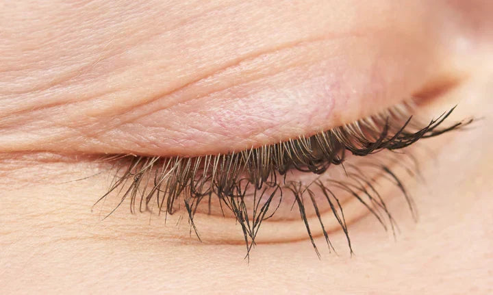 aesthetic treatments? Dysport? The Natural Approach? Confused as f***?! Let’s break it down.
