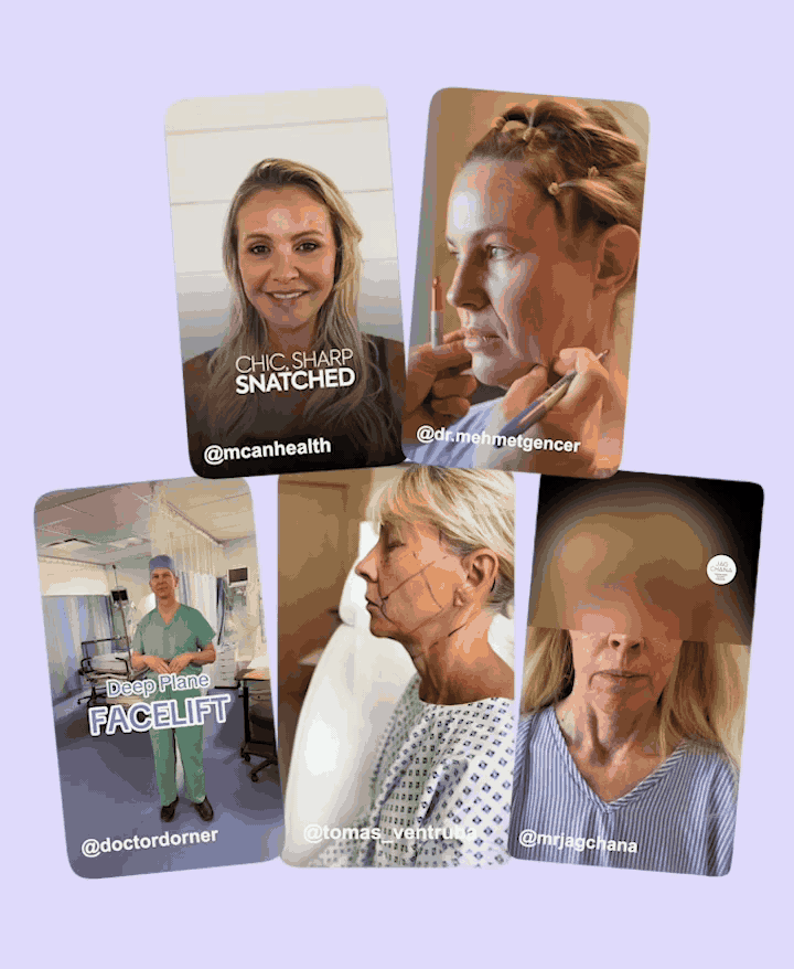 Non-Surgical Facelift: Dreaming Of A Deep Plane Lower Facelift? Try This Instead…