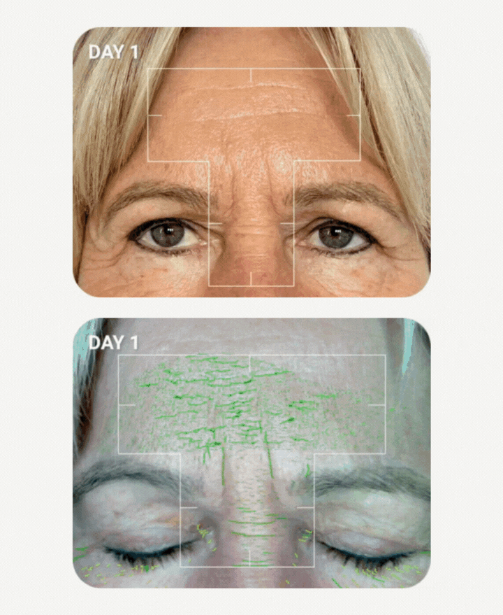 Best Skincare for Mature Skin: Scientific Skin Analysis Reveals 7-Day Results