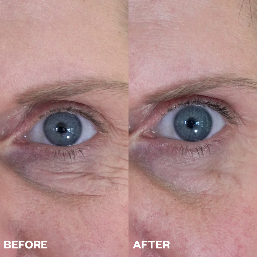 How to Remove Under-Eye Bags: Our Guide to Smoothing Eye Wrinkles