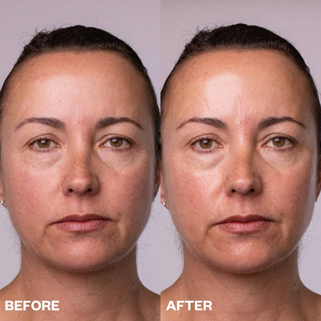 Hydrate & Smooth Forehead Set