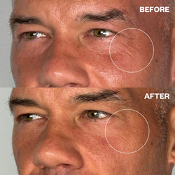 Men's Pro Eye Wrinkle Patches