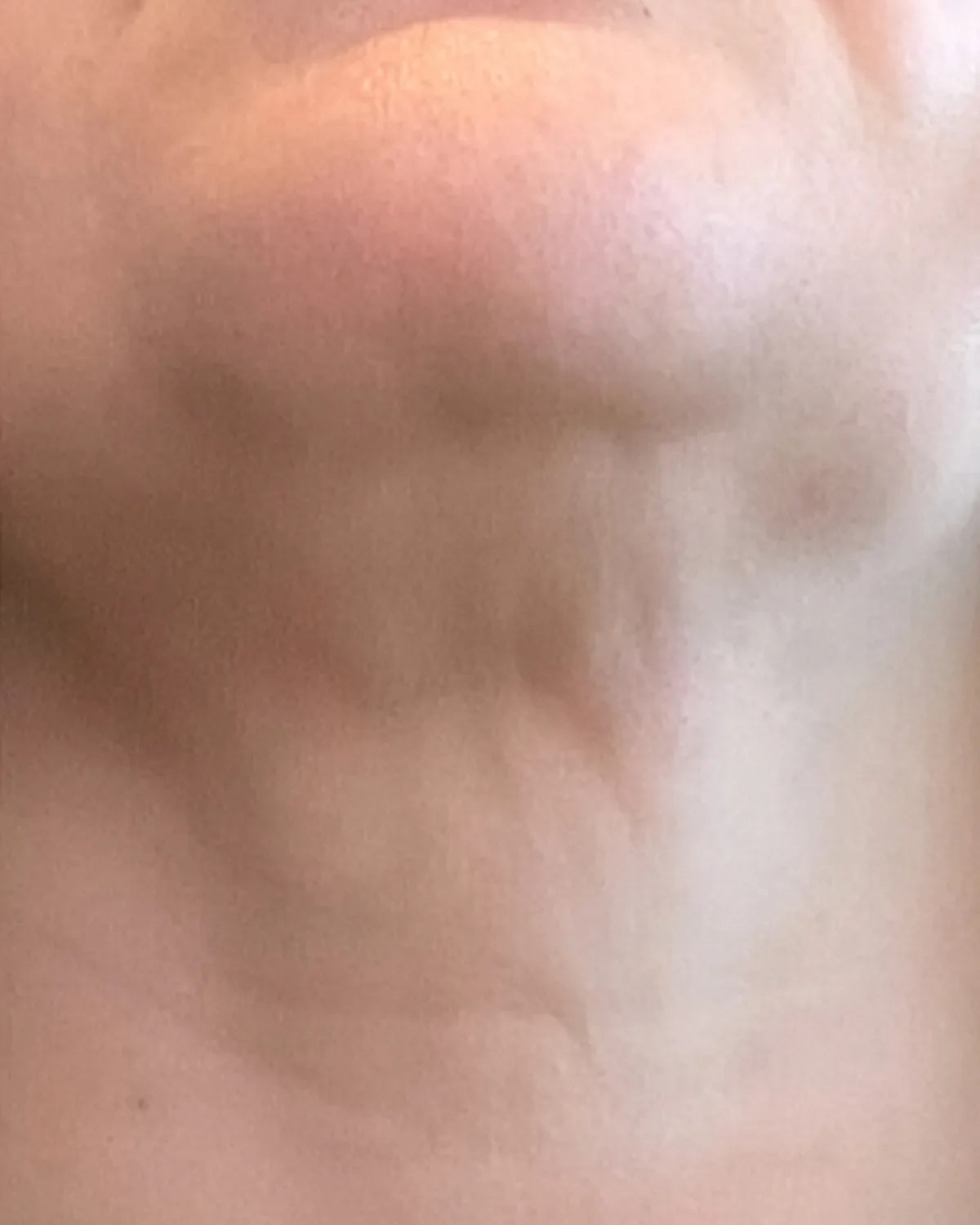 before-neck-carousel-1.webp