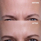 Brow Frown & Bunny Lines Wrinkle Patch | Trial Patch