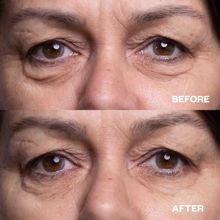 Eye Wrinkle Patches – One Pair