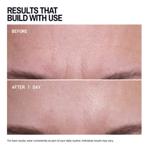 Brow Frown & Bunny Lines Wrinkle Patches
