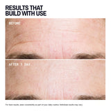 Forehead Wrinkle |Trial Patch