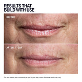 Mouth & Lip Wrinkle | Trial Patch