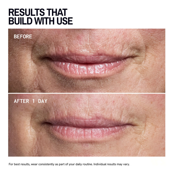 Mouth & Lip Wrinkle | Trial Patch