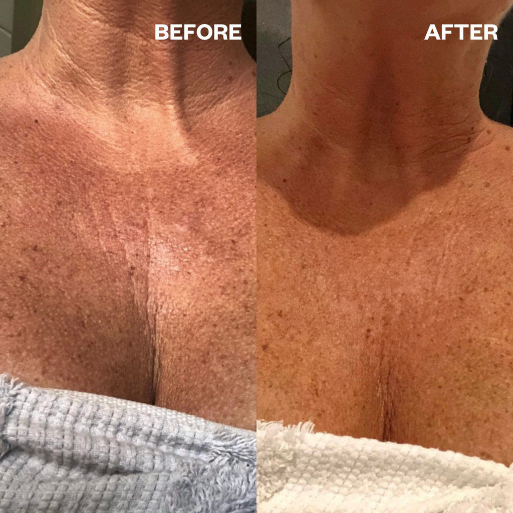 dehydrated skin hydrating sheet mask before and after results