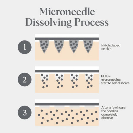 Self-Dissolving Microneedle Patches x 8